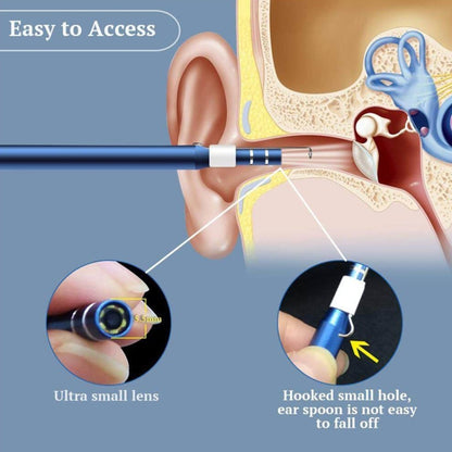 i95 3 in 1 USB Ear Scope Inspection HD 0.3MP Camera Visual Ear Spoon for OTG Android Phones & PC & MacBook, 1.75m Length Cable (Yellow + White) - Ear Care Tools by buy2fix | Online Shopping UK | buy2fix